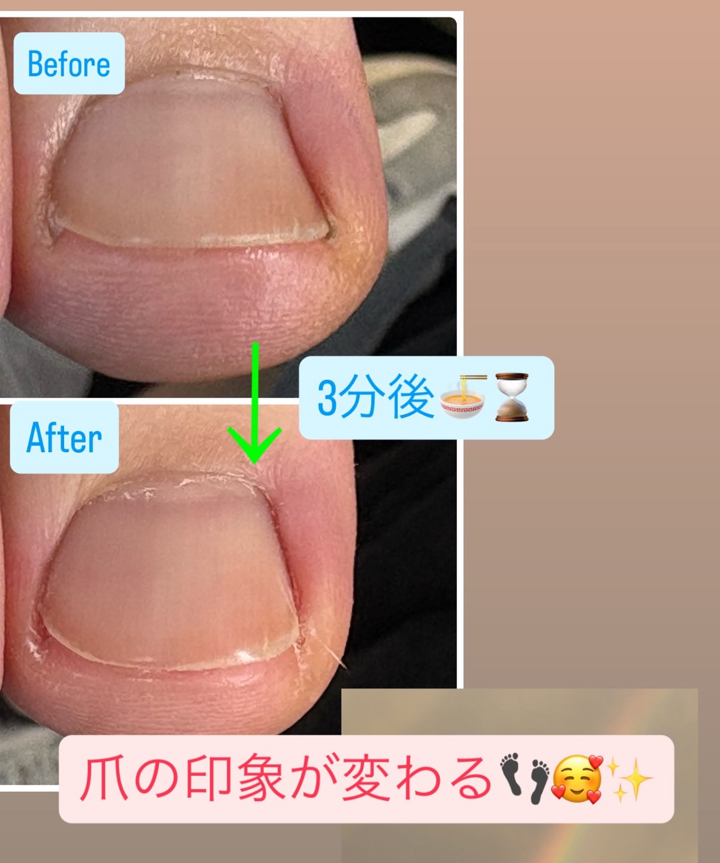 爪が食い込んで痛い~😭💦
.
でもどこに相談したら良いかわからない😣
そんな方も大丈夫🫶🏻
.
トラブルフットケアマスターによる正しい爪切りで、
食い込みを除去し、爪の印象も変わります🦶🏻✨
.
日々体を支えている足🦶🏻
フットケアして労わりましょ~🥰✨
.
.
#フットケア
#ボンマルシェ